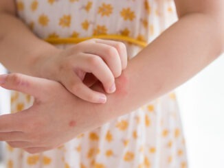 Little girl has skin rash allergy itching and scratching on her arm