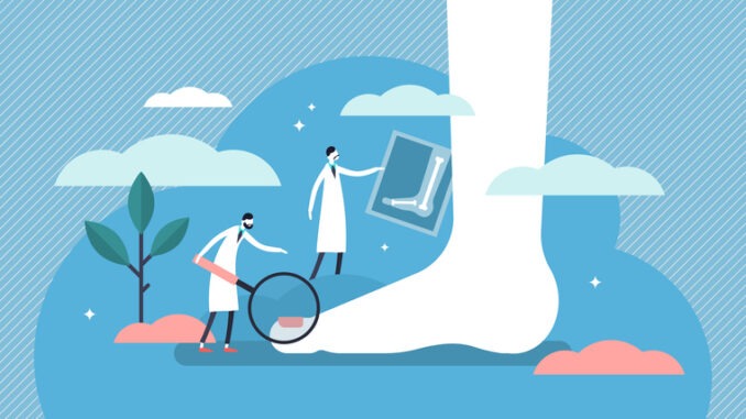 Flat tiny foot, ankle and lower extremity disease persons concept. Feet toe trauma, pathology and illness discomfort treatment with examination, surgery or procedures.